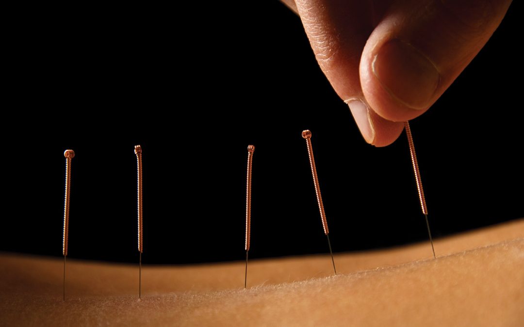 The Science-Backed Benefits of Massage and Acupuncture